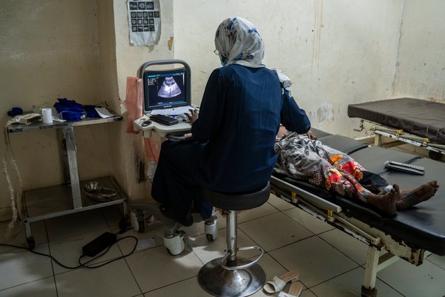 Een echoscopist maakt een echo tijdens een controle. Onze teams runnen een verloskundeafdeling in het El Geneina ziekenhuis. © Diana Zeyneb Alhindawi