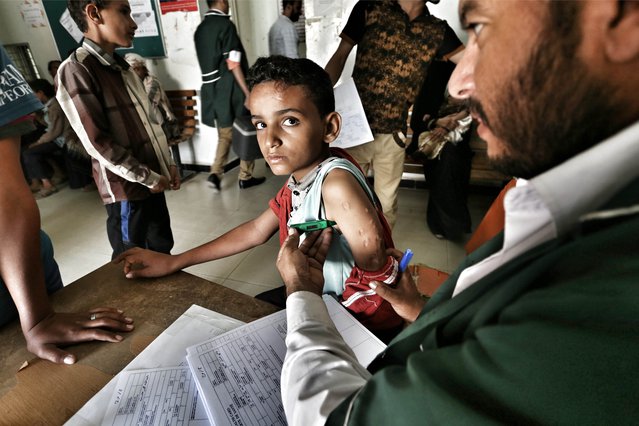 De 12-jarige Ali raakte gewond na bombardementen in Jemen.